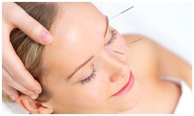 Soin aculifting et acupuncture